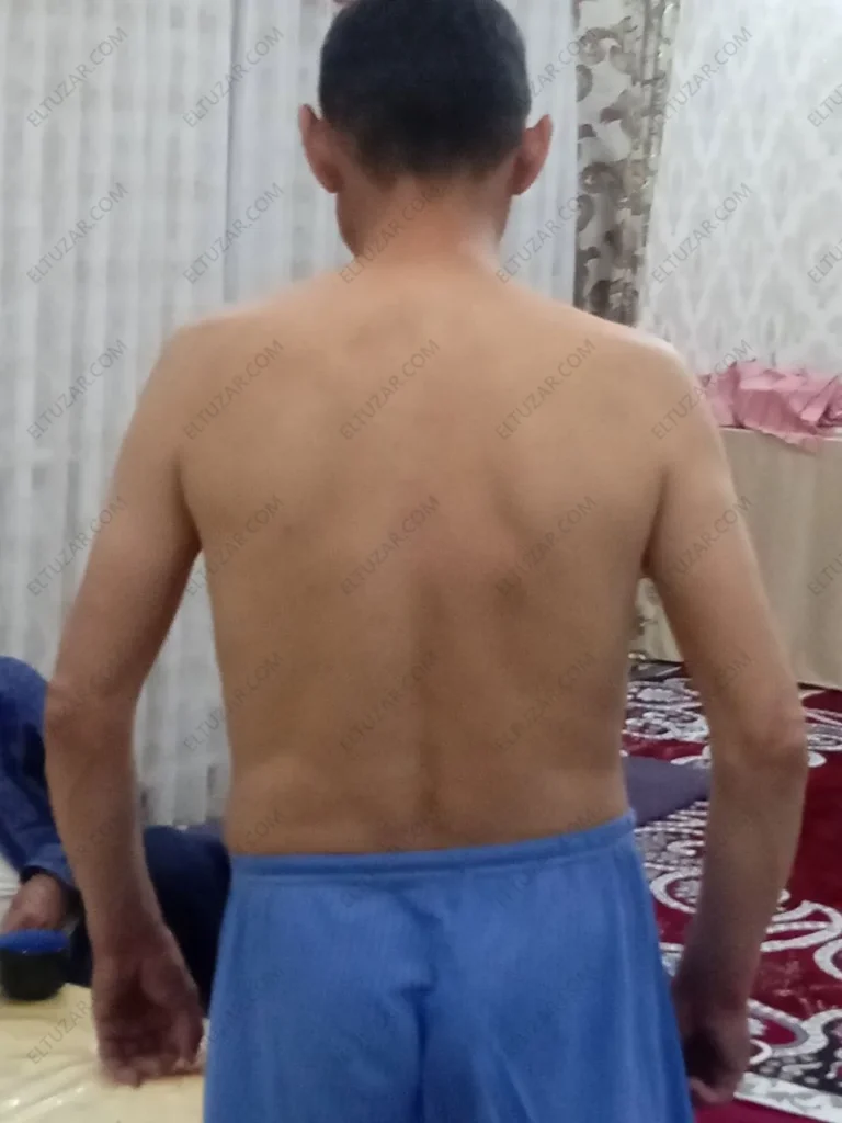 Эркак киши яланғоч бел билан, орқа томонидан олинган сурат. Танасида жароҳат излари бор.